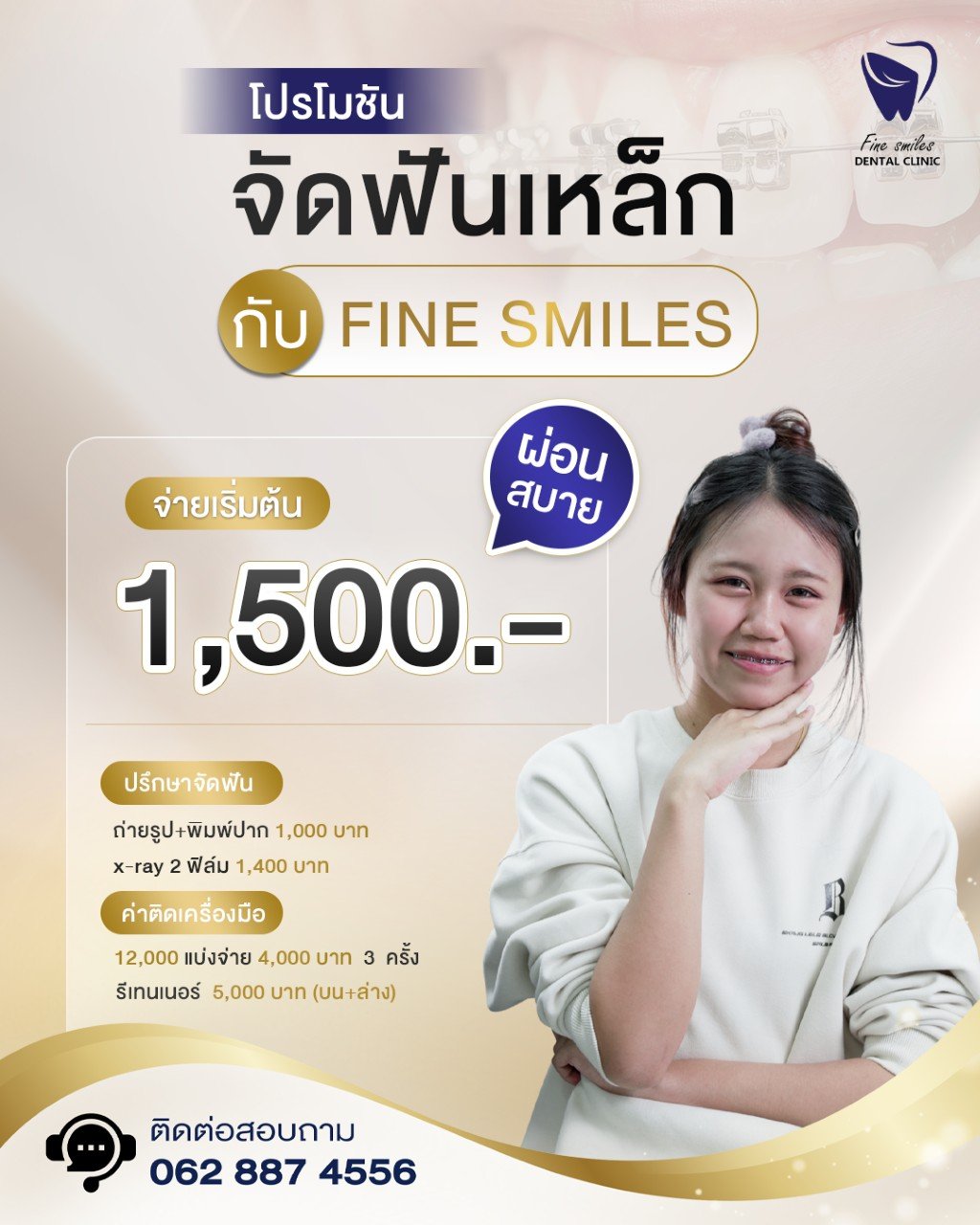 จัดฟันเหล็ก