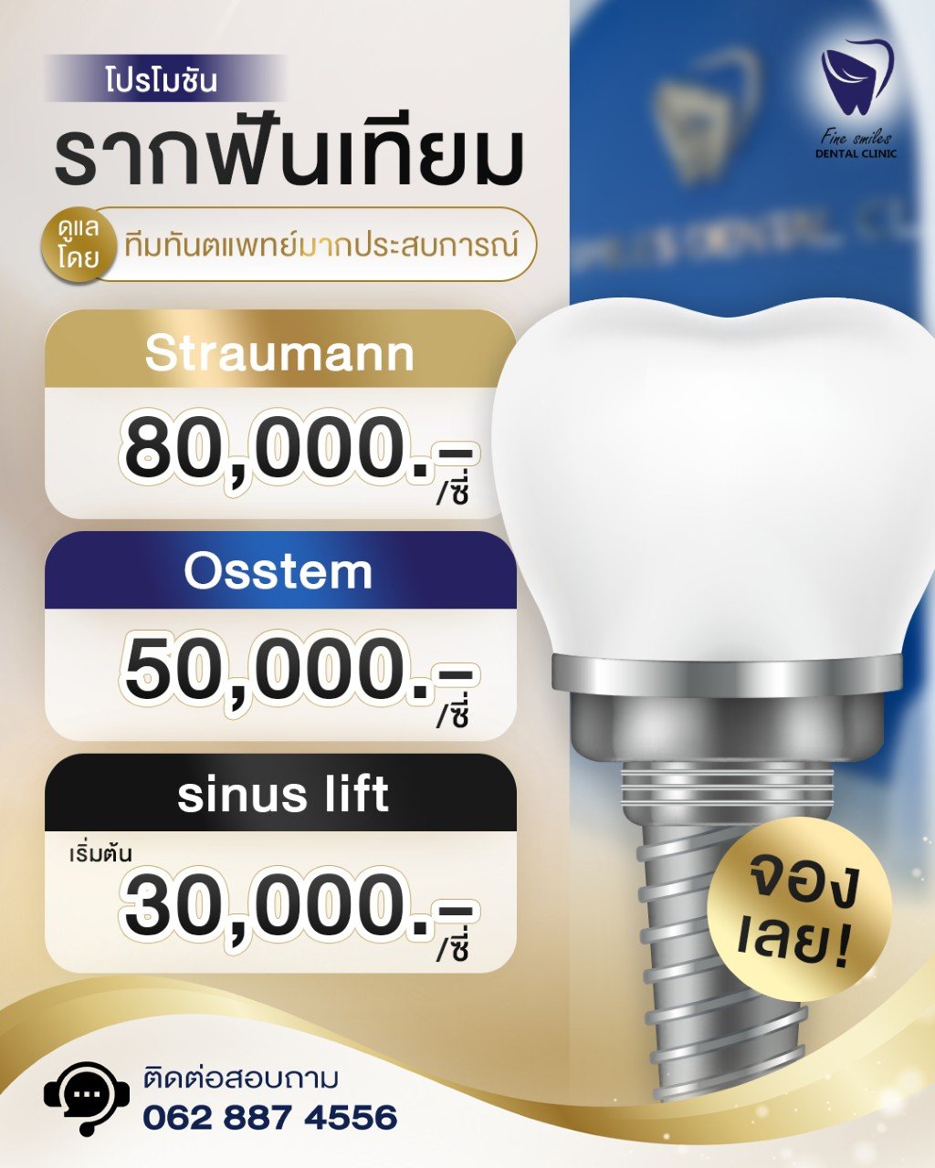 รากฟันเทียม